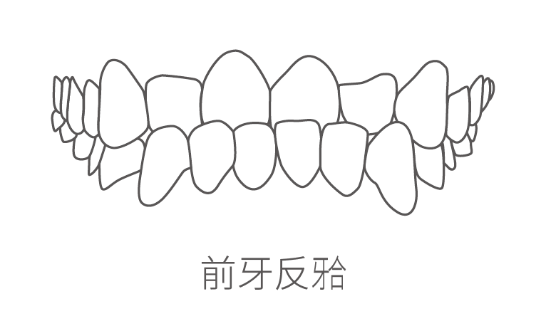 地包天
