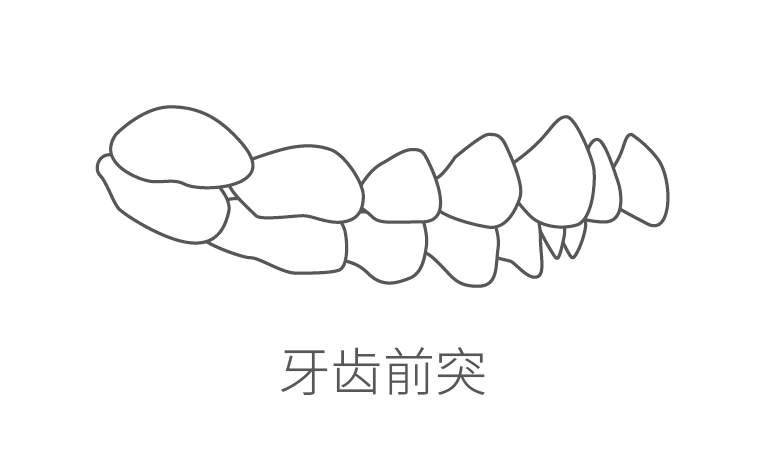 牙齿前突